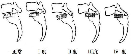 腰椎怎么组词啊