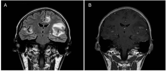 灶怎么组词(灶怎么组词组词语)
