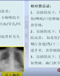 你的鼻子怎么组词啊