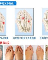 大拇指关节疼怎么组词