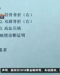 骨折可以怎么组词