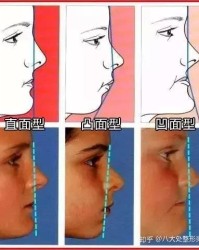 嘴凹的凹怎么组词