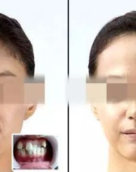 牙齿的脸怎么组词呀