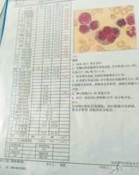 骨髓的谁怎么组词
