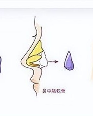 鼻子鼻怎么组词