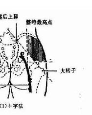 薄肌的肌怎么组词