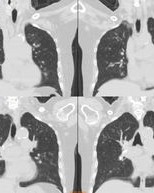 病灶的灶组词(病灶的灶有什么组词)